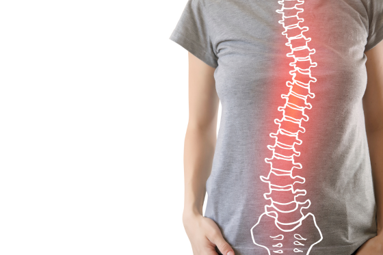 Scoliosis